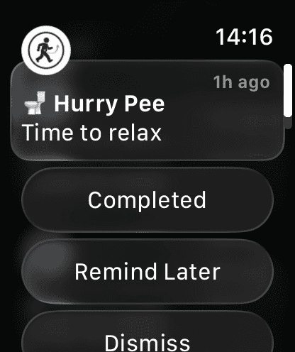 Apple Watch done & later actions
